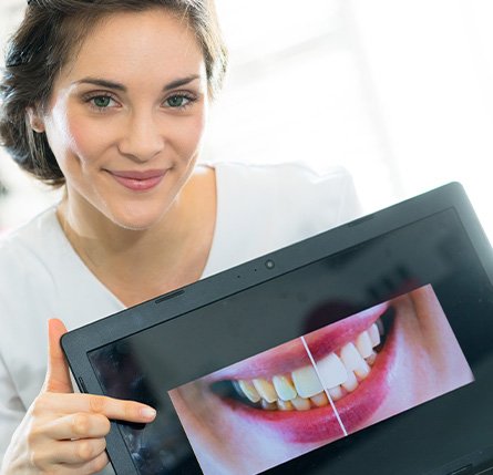 A dental worker holding a frame illustrating before-and-after teeth whitening