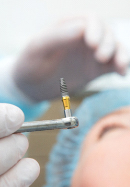 Gloved hand holding dental implant