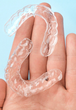 Clear aligners in palm of hand