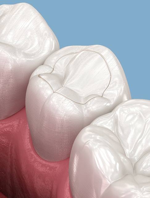 A dentist closely examining a patient’s dental fillings