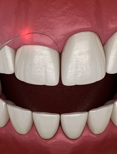 A woman flossing her teeth