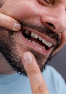 Patient in Parker showing lost tooth