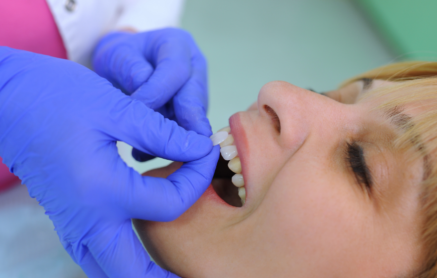 Woman being fitted for veneers