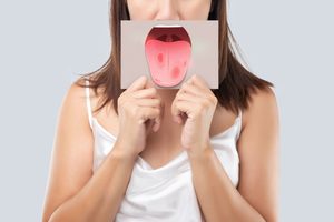 Woman holding image of splotchy tongue in front of her mouth